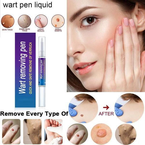 Spot Remover Pen