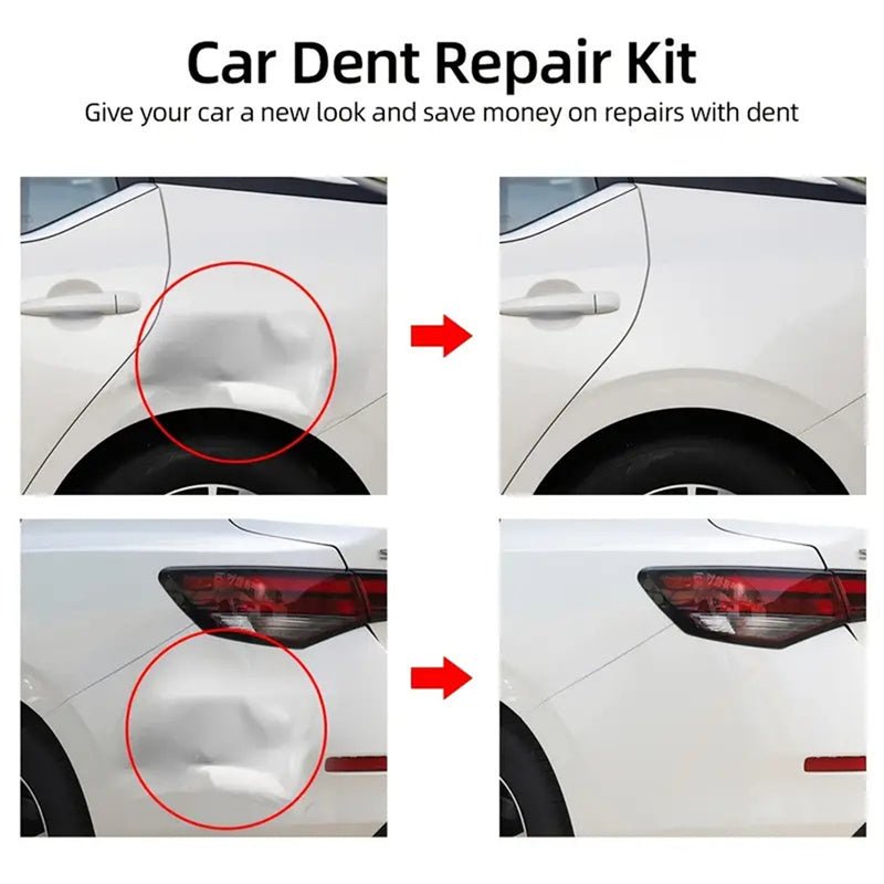 Car Dent Puller - iamlazy.store