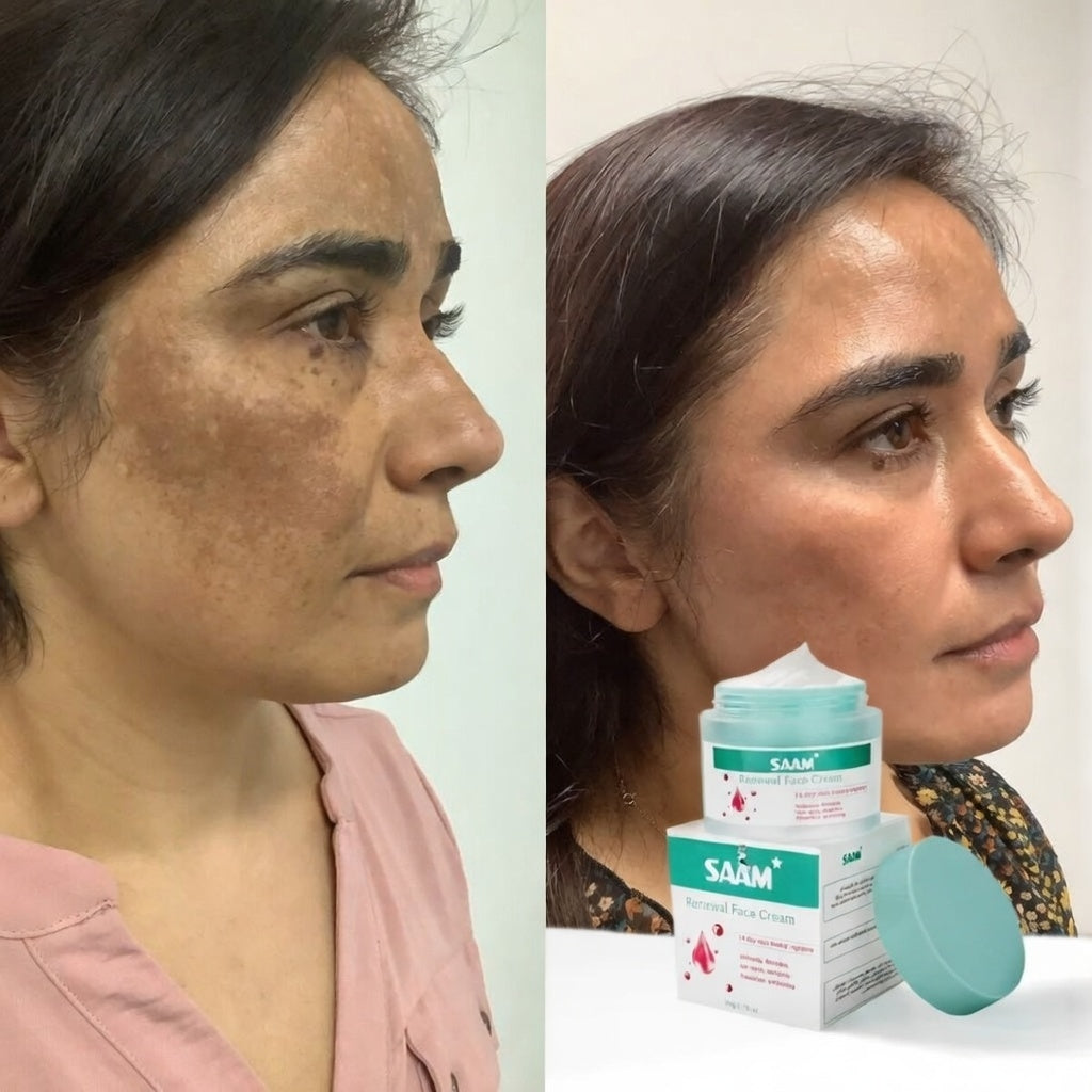 SAAM RENEWAL CREAM - Original