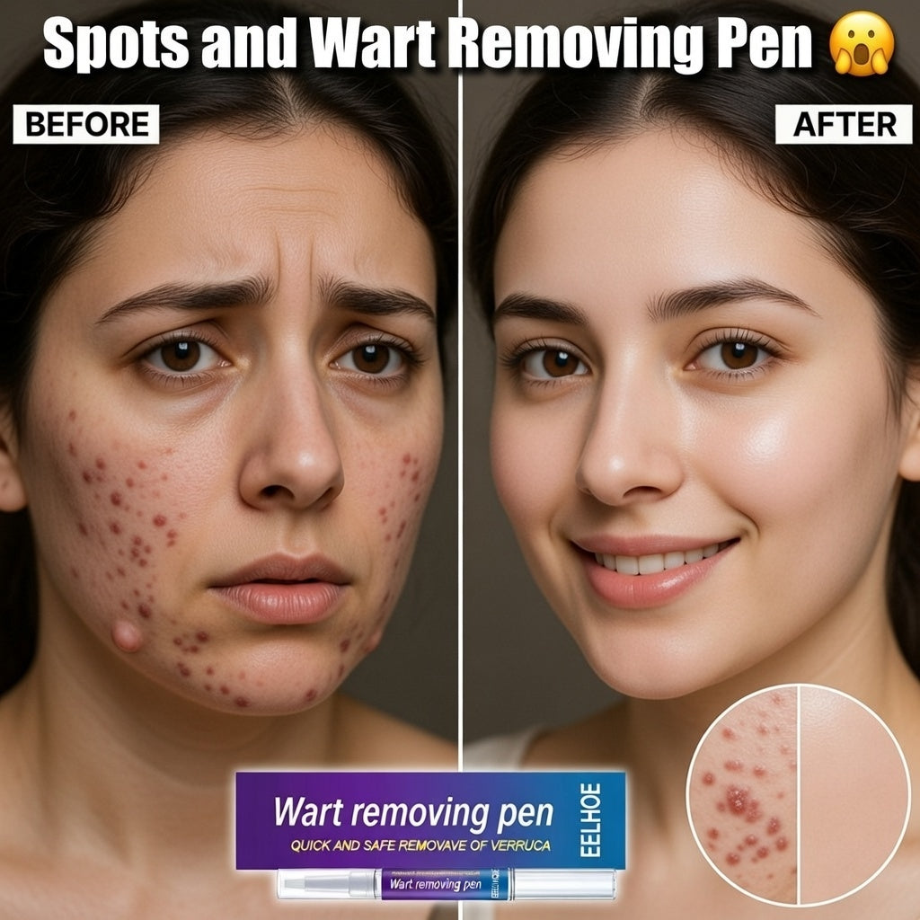 Spot Remover Pen