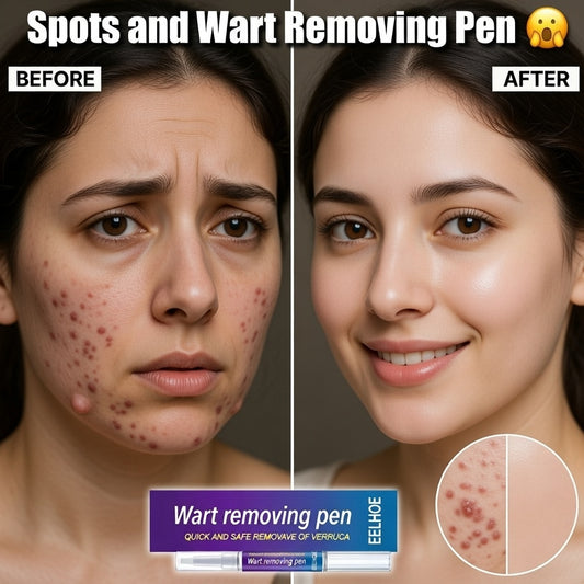 Spot Remover Pen