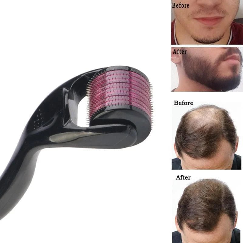 Hair Growth Roller - iamlazy.store