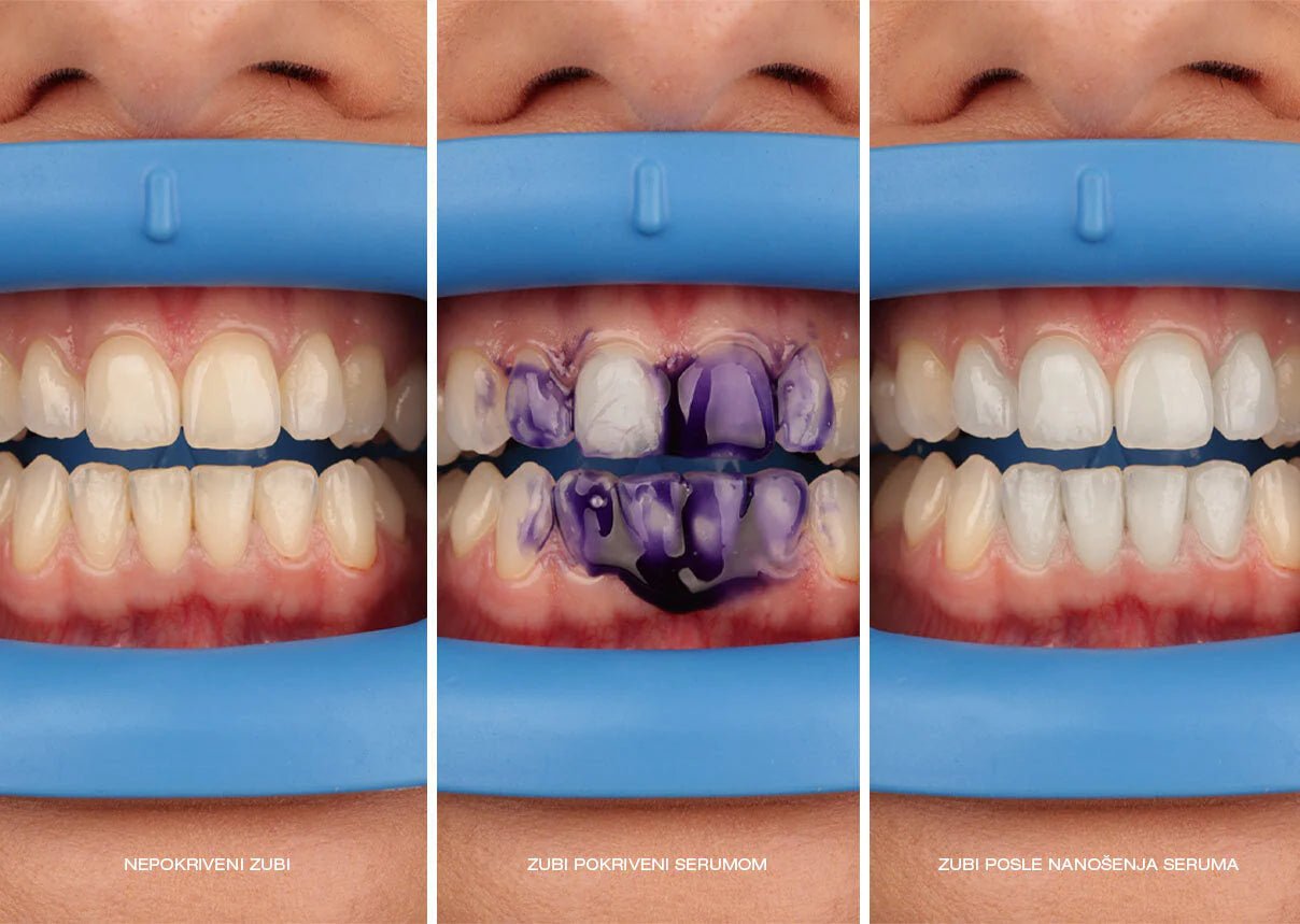 Hismile Colour Corrector | Tooth Stain Removal | Teeth Whitening Booster - iamlazy.store