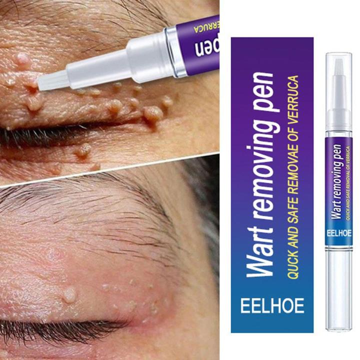 Spot Remover Pen - iamlazy.store