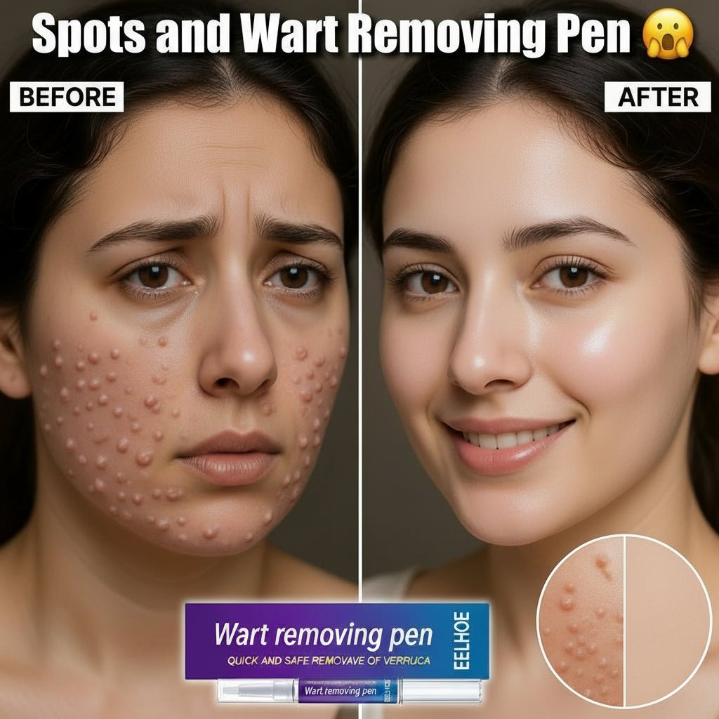 Spot Remover Pen - iamlazy.store