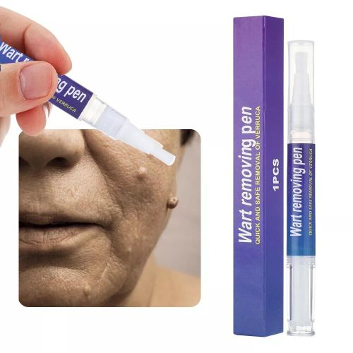 Spot Remover Pen - iamlazy.store