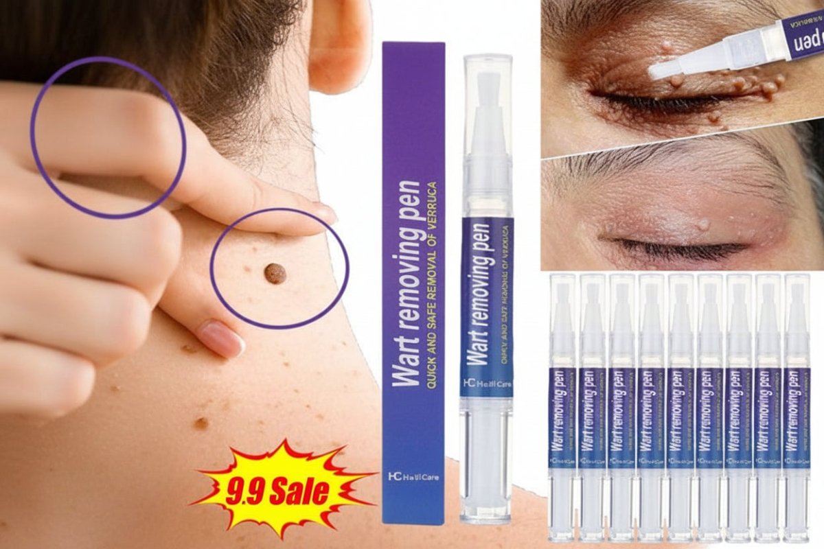 Spot Remover Pen - iamlazy.store