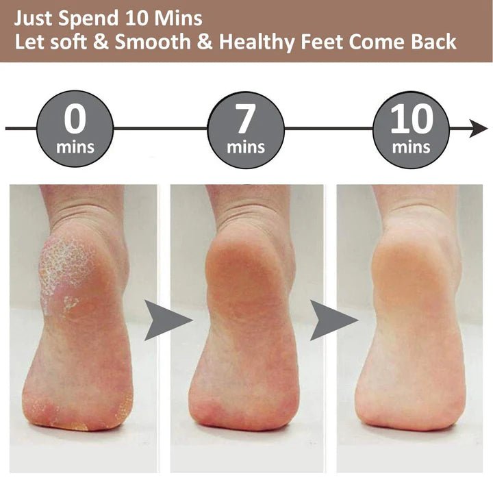 Waterproof Electric Pedi Tool - iamlazy.store